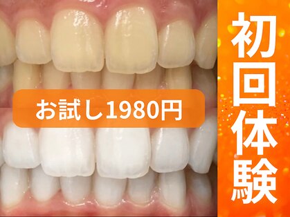 ホワイトニングセンター 谷山店の写真