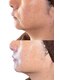 ラ ラナン(La lanun)の写真/筋膜や脂肪層から最新のマシンで小顔デザイン◎