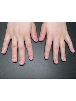 爪の悩みを解消できる（ケア含む）