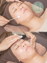 マーベル(MaaBelle) 水光肌 ピーリング