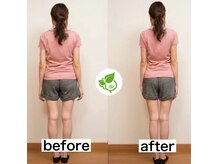 カイロプラクティック ネクサスの雰囲気（エリア希少のマタニティカイロ対応◎産前産後も受付中！）