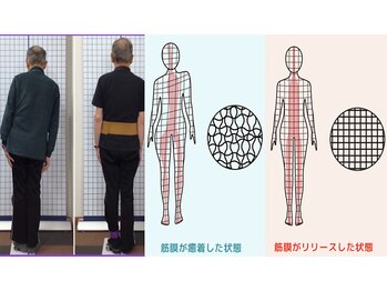 グロース鍼灸整骨院 豊浜院/筋膜リリース
