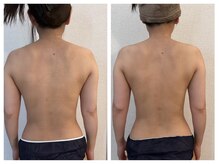 スリーアール(three R)/◆背中　ビフォーアフター◆