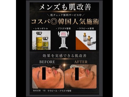 モンド(Mondo)の写真