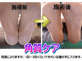 リラコン 那由多(RelaCon.)の写真/角質ケアしたい方必見！☆すべすべな足裏手に入れてください☆