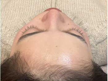 ベイビースキンファクトリー(BABY SKIN FACTORY)/ツヤッツヤ☆憧れの韓国オデコに