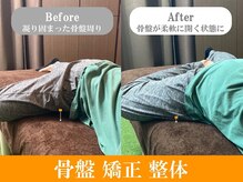 よつば健康管理センター 赤坂 溜池山王店/骨盤の浮き、歪みを整える整体☆