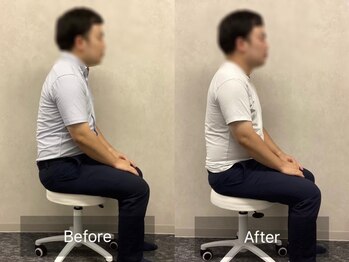 博多おかげ整体院/整体＆姿勢矯正ビフォーアフター