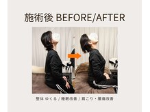 ゆくる/before after