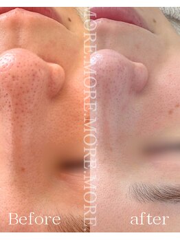 モア 吉祥寺(MORE.)/BeforeAfter