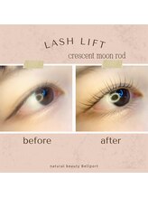 ナチュラル ビューティー ベルポート(natural beauty Bellport)/ラッシュリフトビフォーアフター