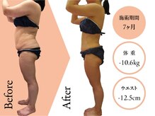 クリニカルエステ イーズ 京橋店/痩身Before-After