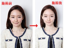 なごやの森の雰囲気（小顔輪郭矯正ビフォアフター♪小顔矯正/姿勢矯正/肩こり/名古屋）