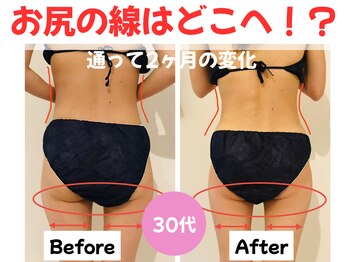 パリライム(parislime)/