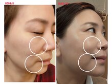 サロンドットブレスドットケイ(salon.bless.k)/ゆる～く継続美容