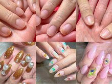 スマイル ネイル ラボラトリー(Smile nail laboratory)の雰囲気（痛んだ地爪も通う度に健康的な爪に☆美爪が叶うネイルサロン♪）