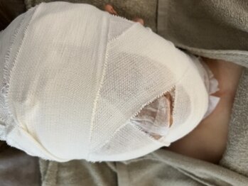 private salon Ponola【ポノーラ】の写真/【韓国式超小顔術】バンテージ×高濃度炭酸ガスパックで歪み・たるみ改善し理想のフェイスライン☆