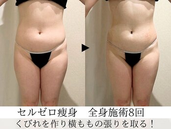 ウイ ネイルアンドビューティー(u'i nail&beauty)/くびれを作りメリハリある身体!