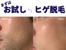 【メンズ】メンズヒゲ脱毛をお試し価格で！ 40分
