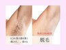 【脱毛】ハイパワー脱毛☆抜け感が別格お試し４か所セレクト脱毛　初回￥6600