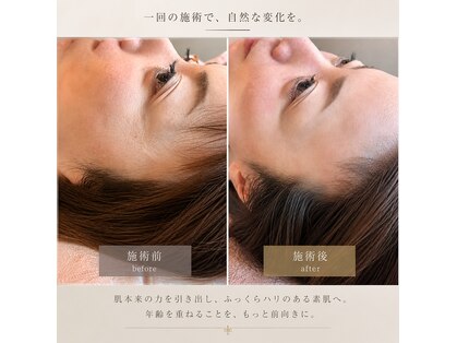 爽健美の写真