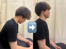 森脇鍼灸整骨院 吹田本院の雰囲気(施術後のビフォーアフター☆ 肩こり/腰痛/整体)