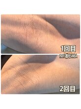 シンバ 倉敷店(SIMBA)/