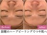 【毛穴・ニキビケアで美肌へ】陶肌トリートメントオプション付90分