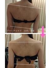 マールム(MALUM)/ブライダル　ケア