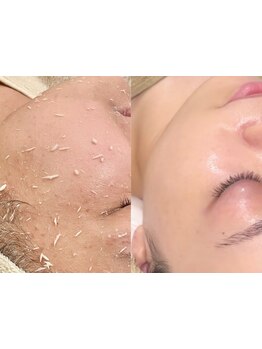 お肌をきれいにしたい