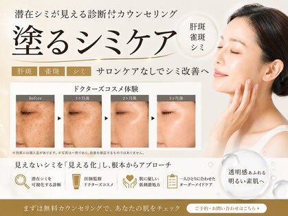 テセラ(Tethere)の写真