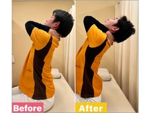 陽だまり鍼灸整骨院/背骨の動きをつけ症状改善します