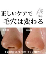ムク(MUKU)/正しいケアで毛穴は変わる