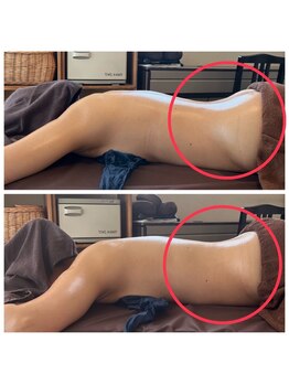 ヌーアンドコードット バイ リンパシー(Nu & Co. by Lymphthy)/夏までに痩せたい!!