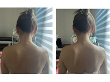 アネラ(Anela)の雰囲気（光エステのみ beforeAfter）