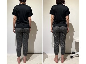 ヴィヴィアナ(viviana)/全身美矯正でスタイルが変わる