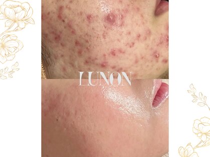 ルノン 天神店(LUNON)の写真