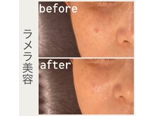 お気軽ビューティエーヴィヒ(Ewig)の雰囲気（エステは全てオーナー施術♪ハーブピーリングやラメラ美容が◎）