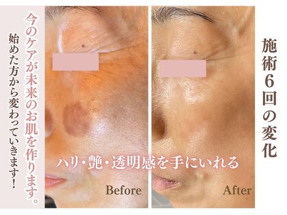 グラチア(Gratiae)の写真