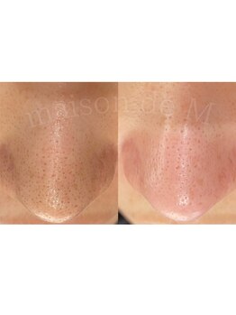 メゾン ド エム(maison de M)/