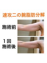 鍼灸サロンオランジュ 高槻富田院/
