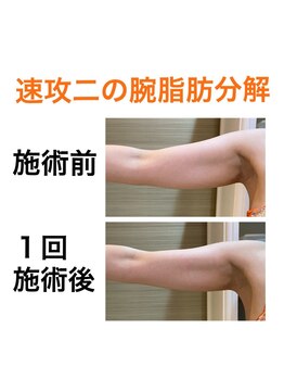 鍼灸サロンオランジュ 高槻富田院/