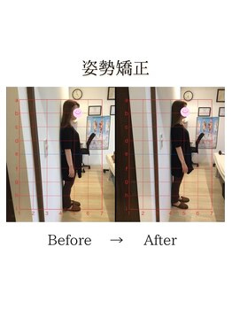 心斎橋長堀フェムテック整骨院/19姿勢矯正　骨格矯正と骨盤矯正