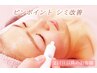濃いシミに！ピンポイントシミ改善ケア　30分