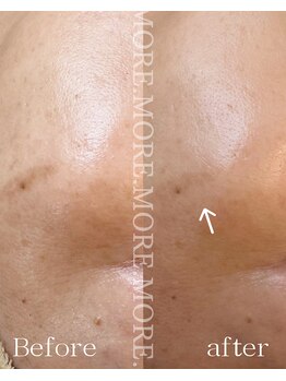 モア 吉祥寺(MORE.)/BeforeAfter