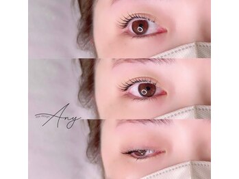 エニー(Any)の写真/特殊なトリートメントの使用で、ダメージを抑え長くキープできるL３ラッシュリフトの取り扱い有♪