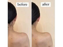 ビフォーアフター#リンパマッサージ#リンパ#肩こり