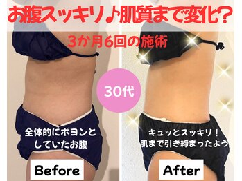 パリライム(parislime)/