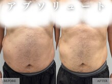 レヴェリー 心斎橋店(REVERIE)/‐ 男性のビフォーアフター ‐