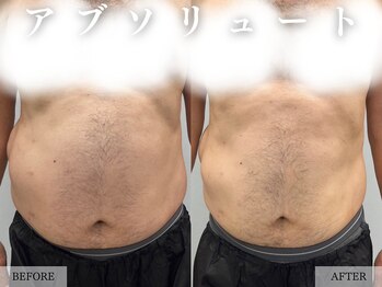 レヴェリー 心斎橋店(REVERIE)/‐ 男性のビフォーアフター ‐